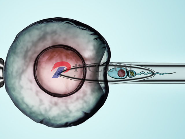 4种传男不传女的遗传病盘点,如有必要请选择第三代试管助孕(图4) 第三代试管可以避免遗传病