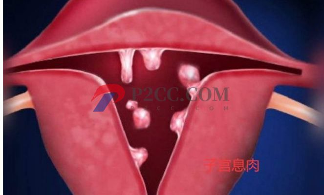 排卵期性腹痛和出血是怎么回事,需不需要治疗?(图2) 排卵期性腹痛和出血是怎么回事,需不需要治疗?(图2)