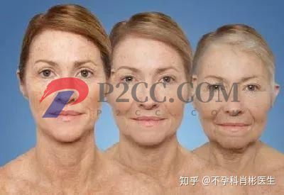 40岁绝经和55岁绝经有什么区别?(图2) 40岁绝经和55岁绝经有什么区别?(图2)