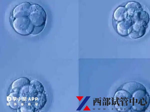 试管婴儿成功率由什么决定