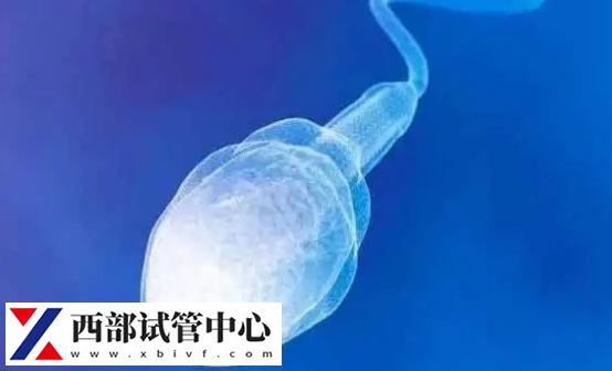 想看懂精子碎片分析与精子形态分析,正常精子大于30%(图1) 精子碎片率小于10%是正常范围