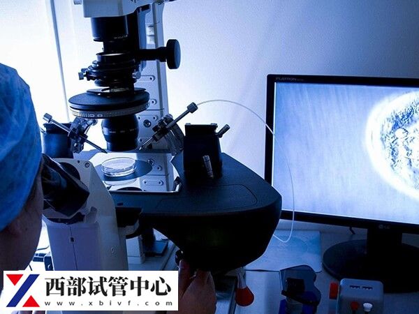 30岁卵巢早衰做试管有没有希望(图1) 卵巢早衰做试管婴儿有希望