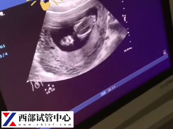 监测卵泡破裂:彩超和阴超1分钟讲清!(图2) 能不能选择彩超来检查卵泡是否破裂