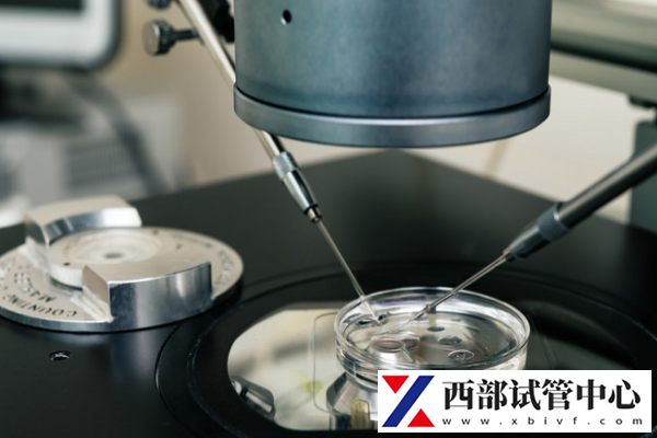 试管婴儿移植最佳时间是什么时候?揭秘科学安排的重要性!(图1) 种植窗期间需要注意什么