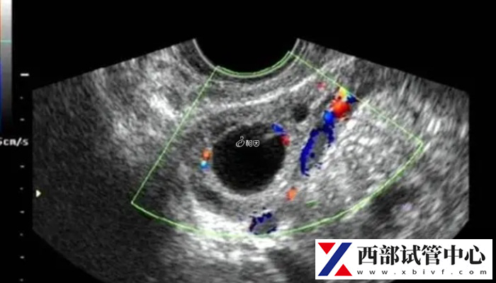陕西13项辅助生殖技术有哪些(图2) 8d72622ce53c0e12f96649f4d279bb5a_MoMwP7Vo4T1727339793257.jpeg
