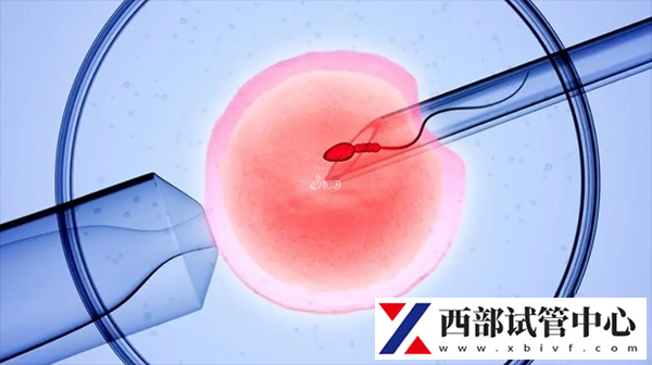 陕西13项辅助生殖技术有哪些(图3) 84fc11211669af4b95e5ea400a09205a_Q9B111IO5Q1727339828158.png