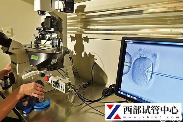 青海省供卵试管婴儿花费明细表一览,一次成功助孕费用最低(图3) 试管一次成功助孕开销最低