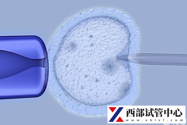 想知道青海省试管成功率多高看过来(图2) 不同辅助生殖技术临床妊娠率不一样