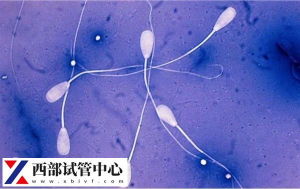 在四川省人民医院做精子碎片检查的价格是多少?(图1) 精子检查最好去正规三甲医院