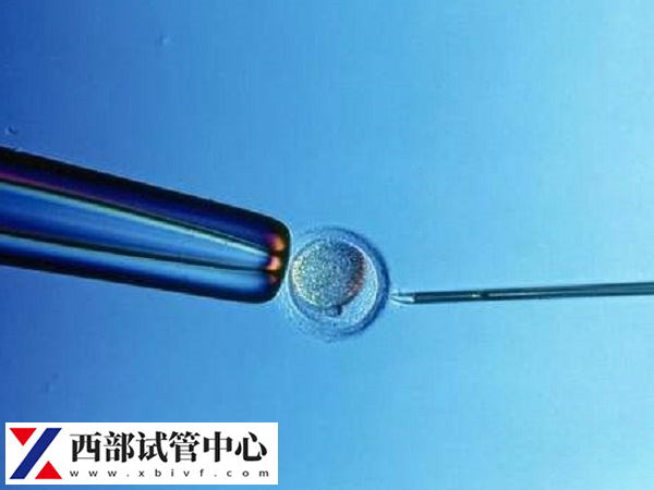 重庆试管婴儿成功率有50%