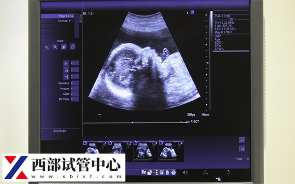 fsh10.8做试管成功率不高