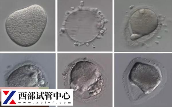 试管3个囊胚pgs筛选成功率,需结合胚胎质量进行判断(图1) 3个囊胚筛选<a href=https://www.nzzt.cn/topic/92.html target=_blank class=infotextkey>成功率</a>大概在40%-45%左右