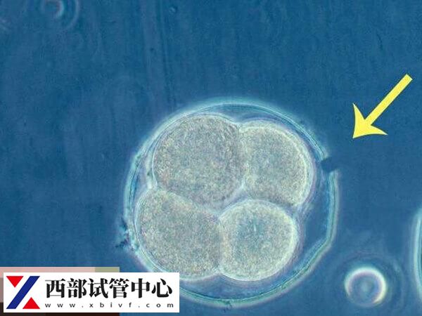 囊胚解冻移植流程及费用分享,另附移植注意事项参考(图1) 胚胎冷冻技术是辅助生殖技术的衍生技术