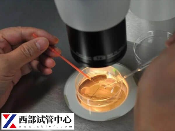 试管移植又称体外受精-胚胎移植