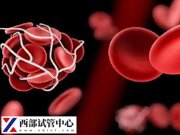 长期卧床容易形成静脉血栓