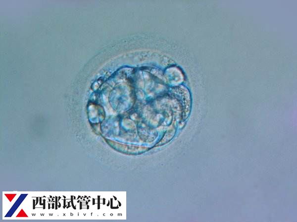 试管移植13天水印正不正常看这,或与胚胎着床有关别不知(图1) 试管移植后会出现一些症状表现