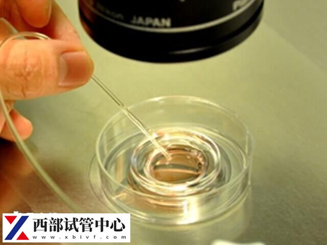 平衡易位三代试管经验是什么(图1) 染色体易位需要做第三代试管婴儿